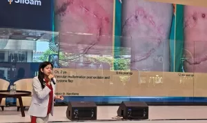 Perdana Bedah Plastik, Rekonstruksi dan Estetik dengan Standar Korea Selatan di Siloam Hospital TB Simatupang