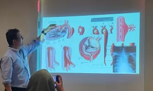Kecepatan Menjadi Kunci Penyelamatan Nyawa pada Penanganan Penyakit Aorta Kompleks di Era Modern